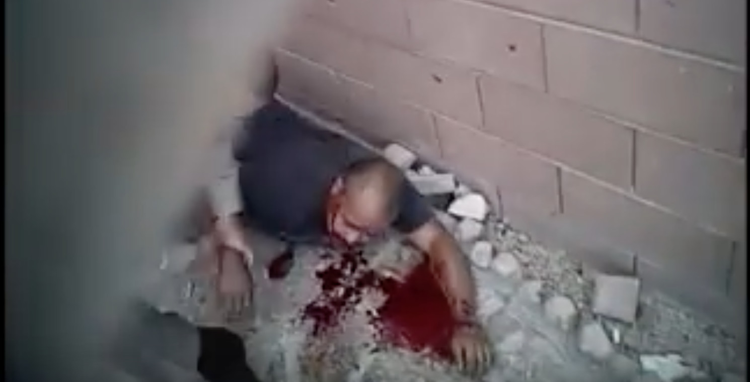 Ανδρας χάνει λίτρα αίμα από σφαίρα στην αρτηρία – Δείτε πως τον σώζει ο αστυνομικός (βίντεο)